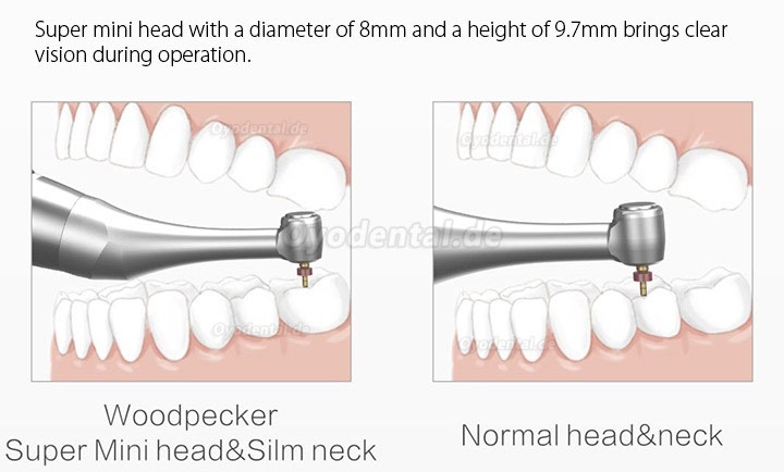 Woodpecker Motopex Bürstenlos Motor de Endodontie mit Apexlokalisator